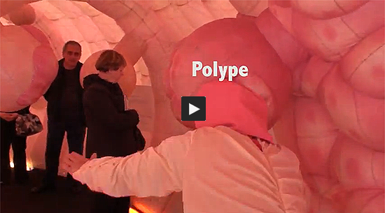 Exploration d'un côlon géant